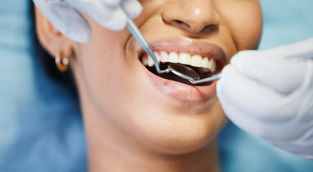 Best Emergency Treatment for Dental Infections or Abscesses in Elmwood, IL